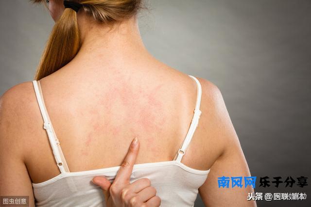 痘痘“蔓延”到了背上？教你四招，解决背部痘痘
