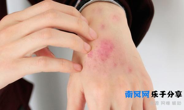 为什么有的女性夏天会使用乳贴？女性用乳贴，该注意些什么？