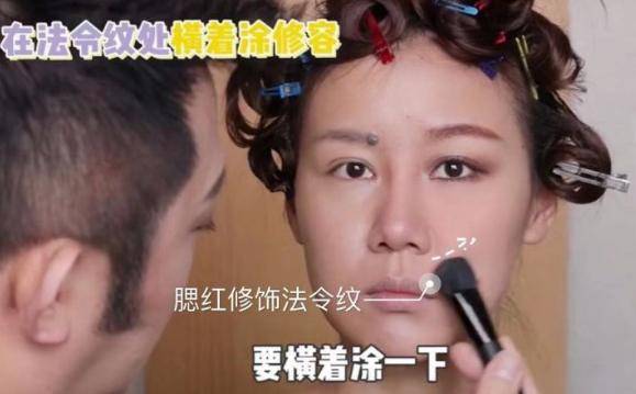 法令纹明显怎么办（法令纹越来越明显这样做）