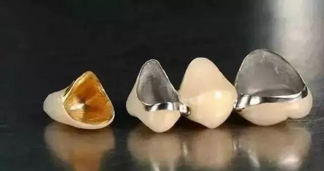 非金属烤瓷牙多少钱一粒（烤瓷牙哪种好）