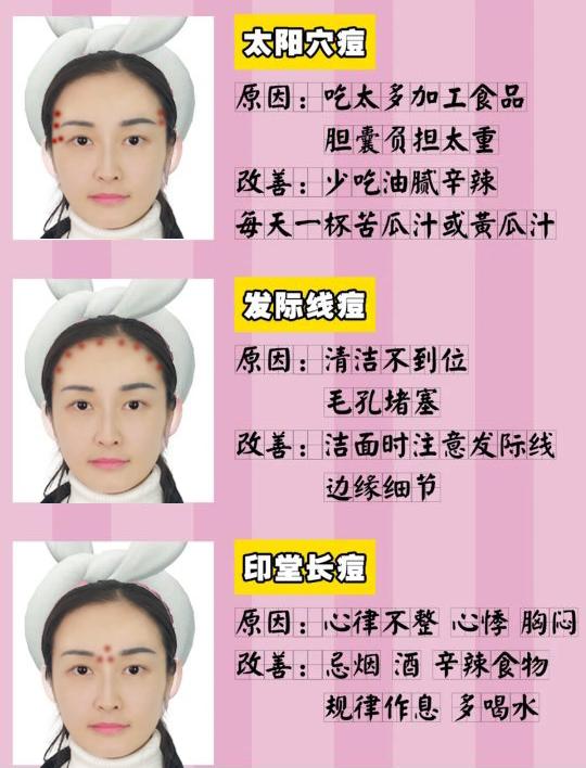 脸部长痘原因分布图（脸上长痘不同位置图解）