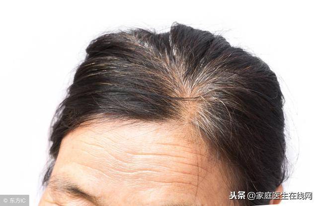 白头发能拔吗？是不是越拔越多?