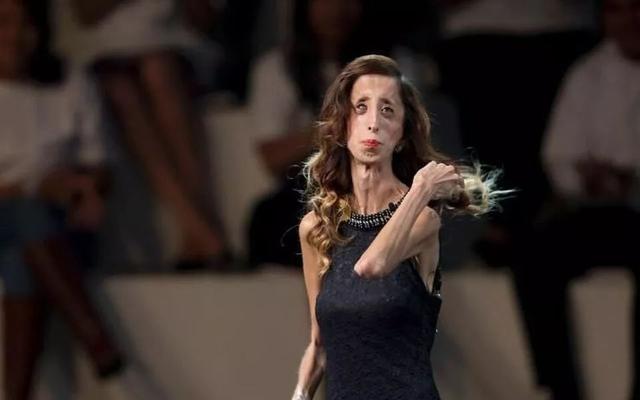 郑欣宜减肥方法大公开（郑欣宜狂减80斤的秘诀）