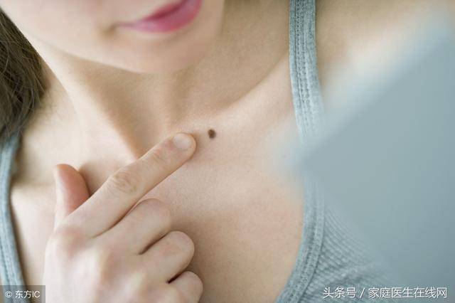 点痣后要注意什么（点痣的最佳季节）