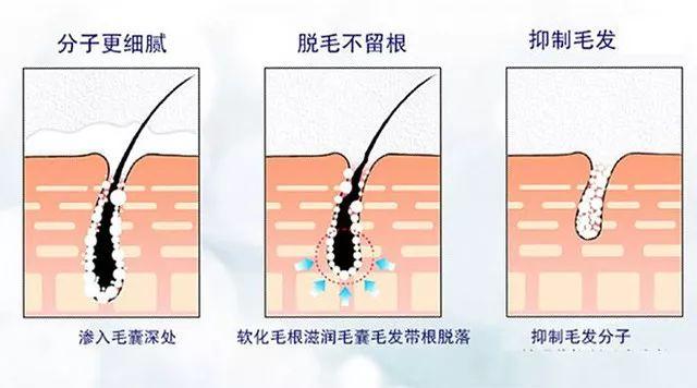 脱毛膏多少钱（脱毛膏多少岁以上能用）