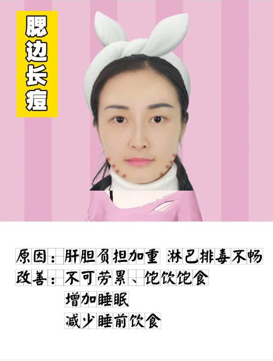 脸部长痘原因分布图（脸上长痘不同位置图解）