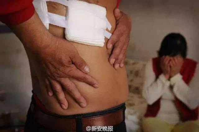 谁偷走了我的肾完整版(高静有结果了吗)