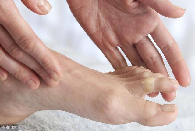 什么是香港脚（得脚气是什么梗）