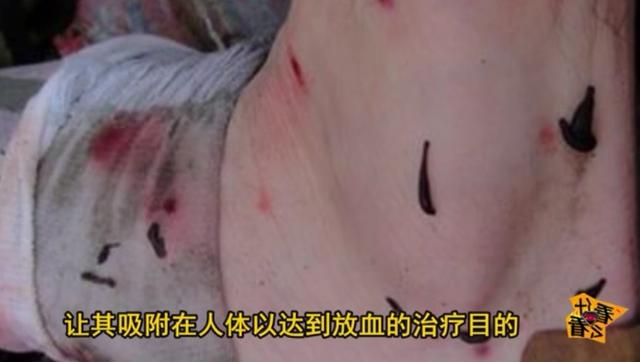 水蛭怎么吃?水蛭的功效与作用!