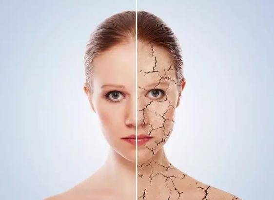 法令纹明显怎么办（法令纹越来越明显这样做）