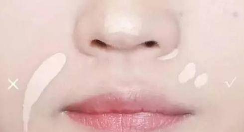 法令纹明显怎么办（法令纹越来越明显这样做）