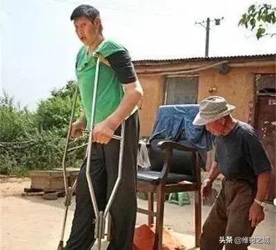 中国第一巨人赵亮现状 中国巨人排行榜！