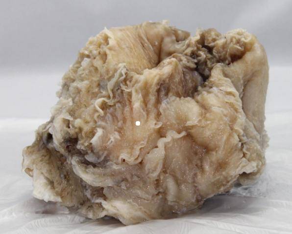 太岁是什么东西（吃活太岁的人现在怎么样了）